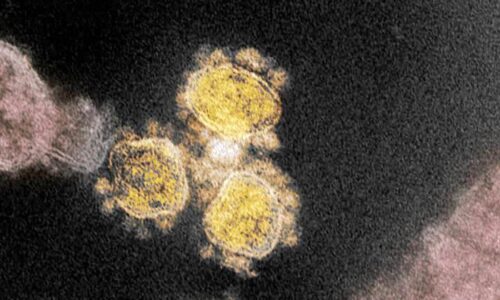 Variante Ômicron chega a quatro continentes; Holanda confirma 13 casos