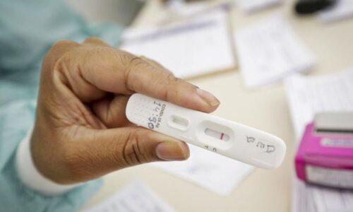 Anvisa aprova venda e uso de autotestes de Covid-19 no Brasil 