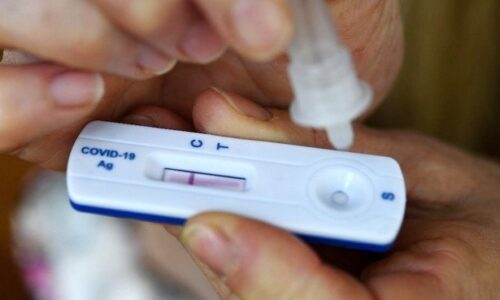 Anvisa decide nesta quarta-feira liberação de autotestes de Covid-19