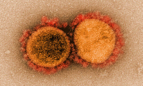 Novo teste de Covid mostra resultado em quatro minutos