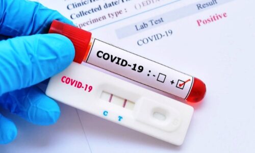 MS tem 409 casos de Covid; 41 são em Costa Rica, município com maior incidência de casos