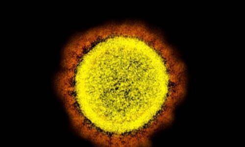 Covid-19 infecta 1,3 mil pessoas e mata sete em Mato Grosso do Sul