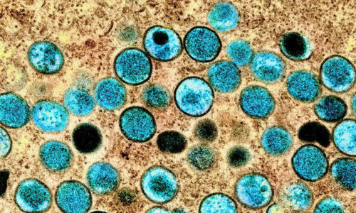 Prefeitura de SP confirma três primeiros casos de varíola do macaco em crianças