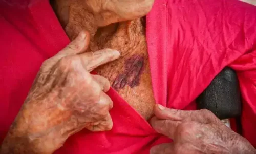 Com 156 casos de violência contra idosos, promotora alerta: “atenção aos sinais”